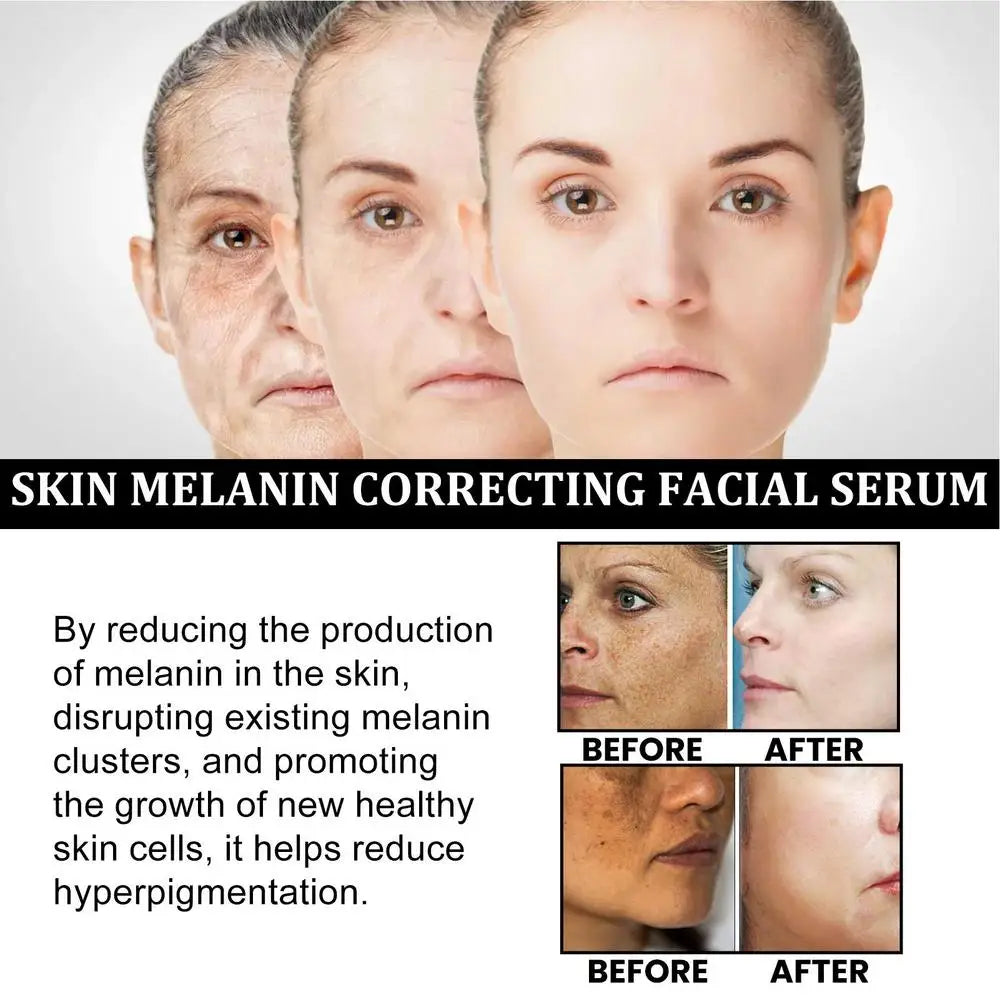 Melanin Correcting Facial Serum Dark Spot Corrector Remover Skin Care Moisturizing Repair Serum Hyaluronic Acid Vitamin C Serum