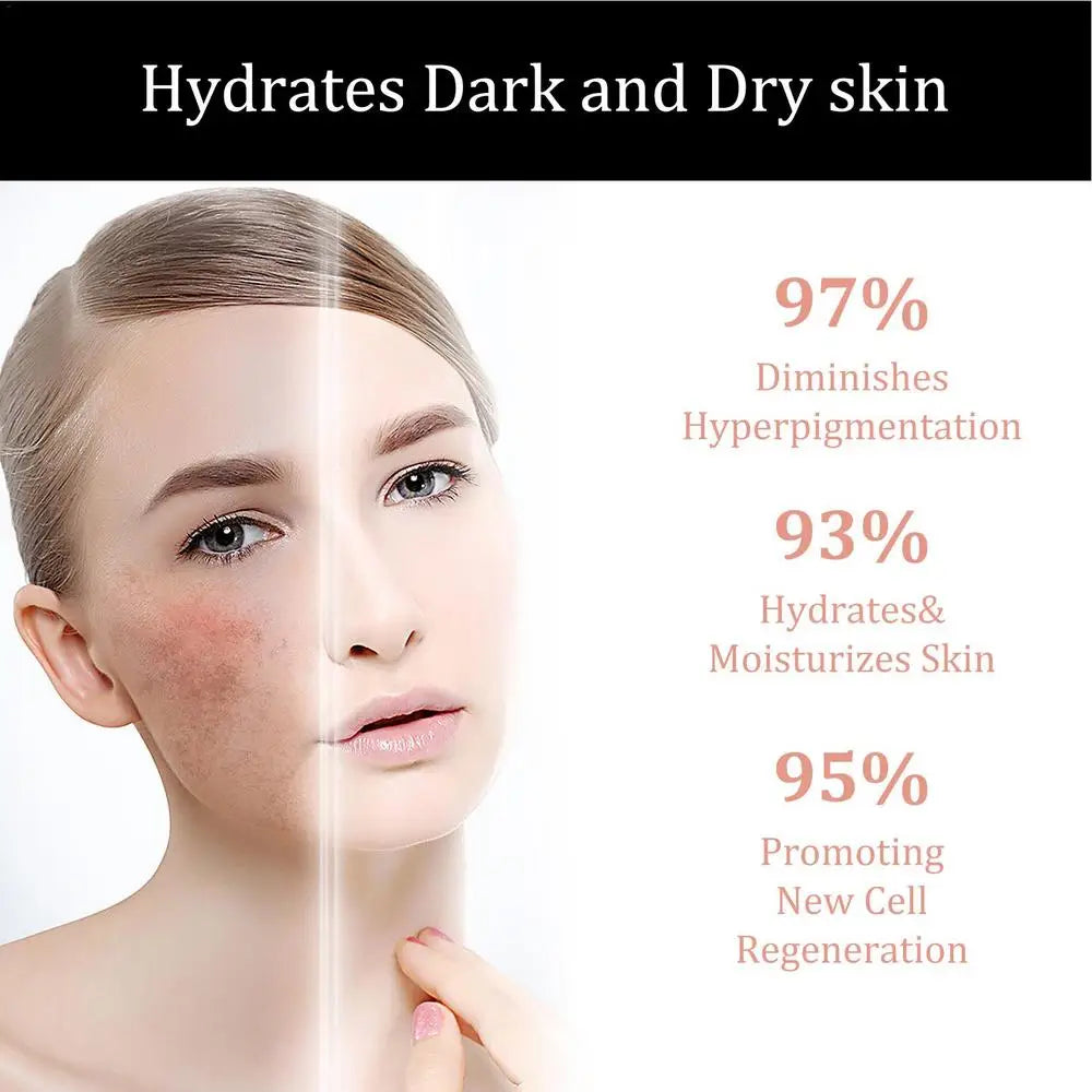 Melanin Correcting Facial Serum Dark Spot Corrector Remover Skin Care Moisturizing Repair Serum Hyaluronic Acid Vitamin C Serum