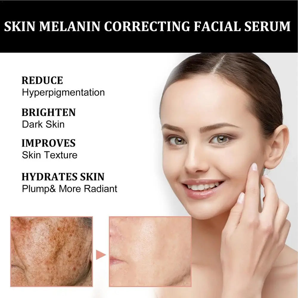 Melanin Correcting Facial Serum Dark Spot Corrector Remover Skin Care Moisturizing Repair Serum Hyaluronic Acid Vitamin C Serum