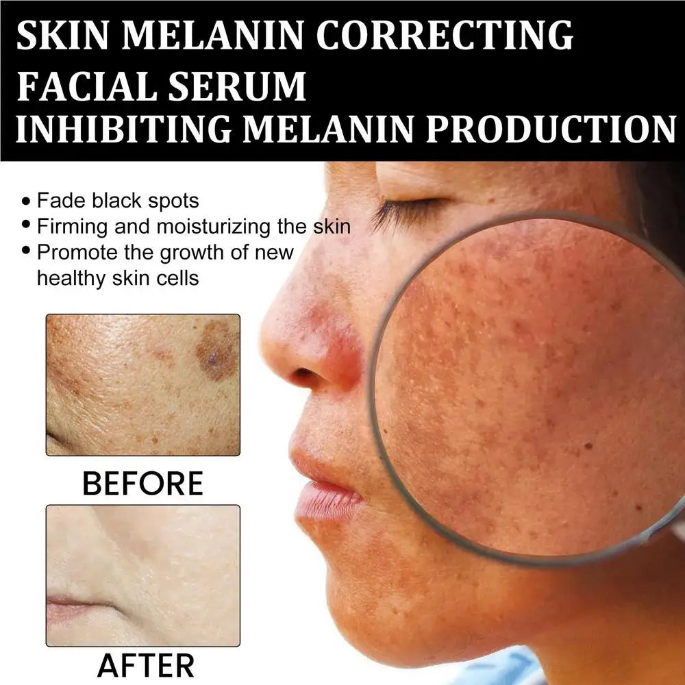 Melanin Correcting Facial Serum Dark Spot Corrector Remover Skin Care Moisturizing Repair Serum Hyaluronic Acid Vitamin C Serum